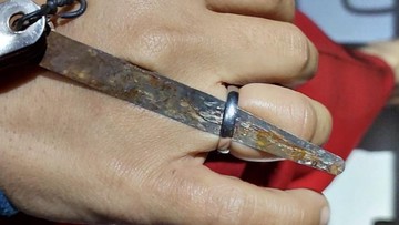 Evakuasi cincin menjepit jari di Sukabumi (Foto: Istimewa)
