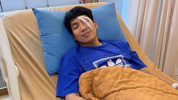 Kondisi Desta usai perawatan cedera mata akibat bola padel (Foto: Instagram @desta80s)