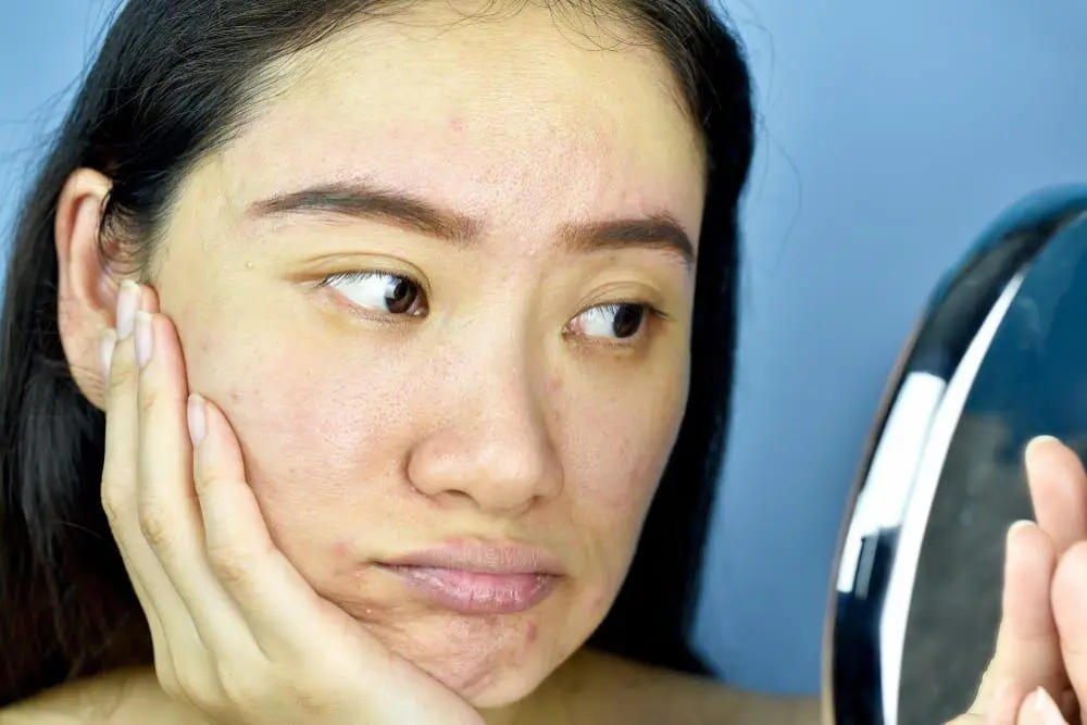Kenapa Kulit Tetap Kusam Meski Sudah Pakai Skincare? Kenali Pentingnya Eksfoliasi