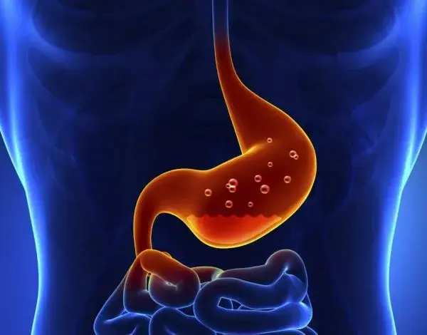 Waspada Silent Killer! Mengapa Langsung Tidur Setelah Makan Malam Berat Bisa Meningkatkan Risiko GERD?