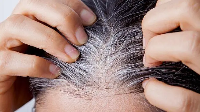 Rambut Hitam Lebih Lama! Ini Daftar Makanan Super untuk Cegah Uban Dini